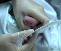 Osakidetza incluye ya una nueva patología en la prueba del talón a bebés recién nacidos