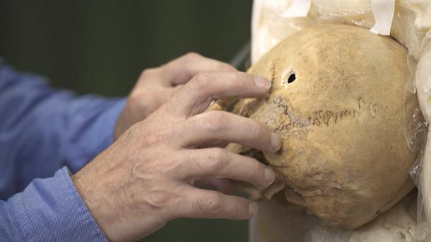 Cráneo de un asesinado durante la Guerra Civil
