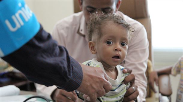 Niño yemení desnutrido