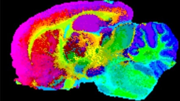 espectrometría de masas de un cerebro de rata