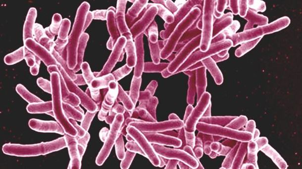Tuberculosis - Mycobacterium tuberculosis - NIAID