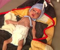 El riesgo de hambruna es ya una realidad para miles de familías yemeníes