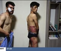 Dos de los periodistas detenidos en las protestas del martes denuncian haber sufrido torturas