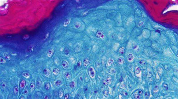 Imagen ampliada con un microscopio de una muestra de piel infectada con el virus. Foto: EFE