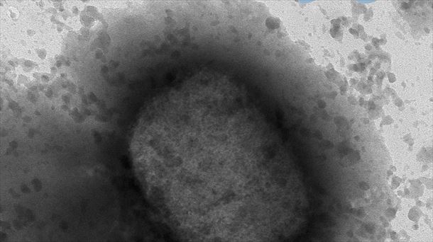 El virus de la viruela del mono en un microscopio. Foto: EFE