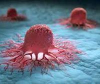 Día mundial contra el cáncer: prevención, nuevas formas de diagnóstico precoz e investigación en tratamientos 