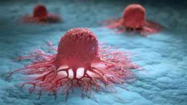 Día mundial contra el cáncer: prevención, nuevas formas de diagnóstico precoz e investigación en tratamientos 